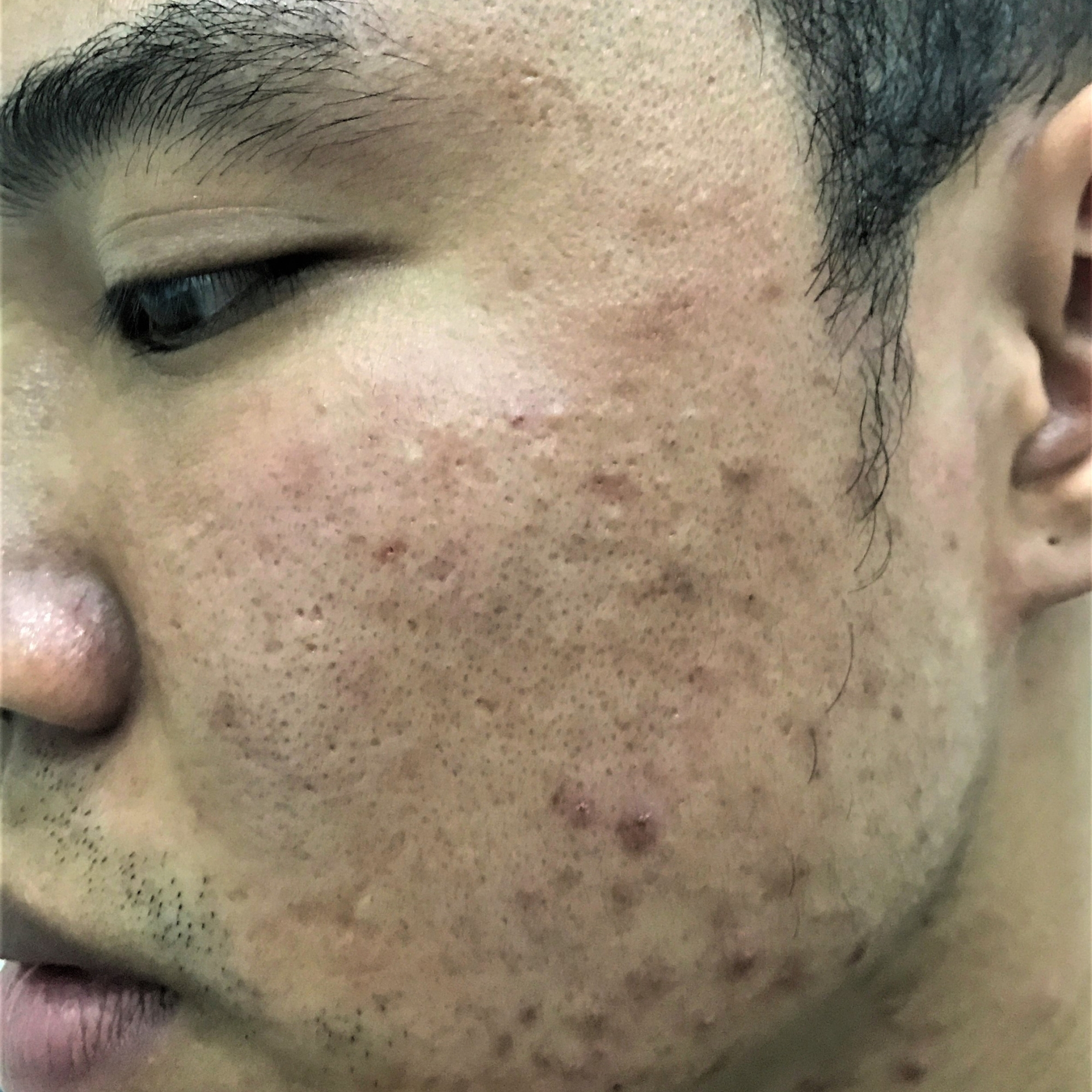 Skincare
