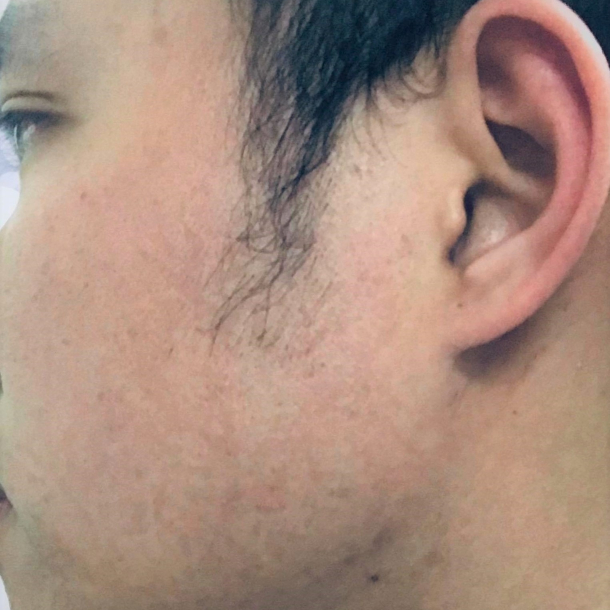 Skincare